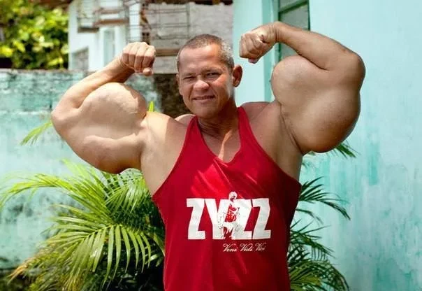 In Brazil, a bodybuilder with the largest biceps in the world has died