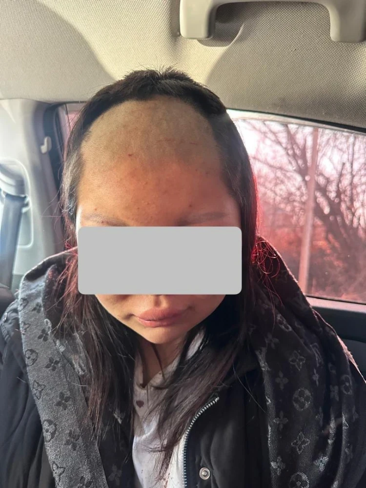 In Jalal-Abad Region, a 17-year-old girl was beaten and shaved. Photo