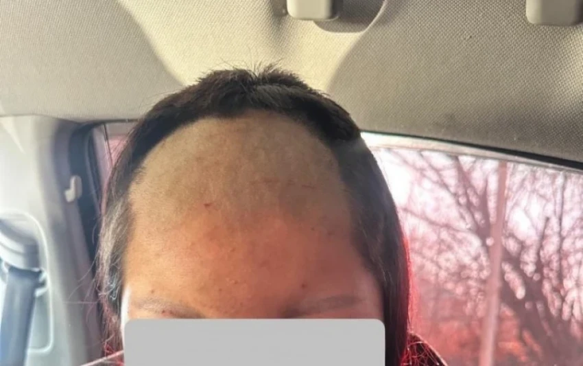 In the Jalal-Abad region, a minor girl was beaten and shaved.