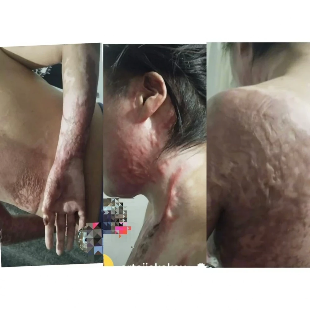 Сотрудник мэрии города Талас заживо поджег свое жену