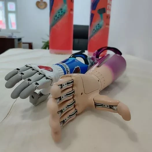 Ministry of Labor of the Kyrgyz Republic: More than 11,500 people received prosthetic and orthopedic services in 2025