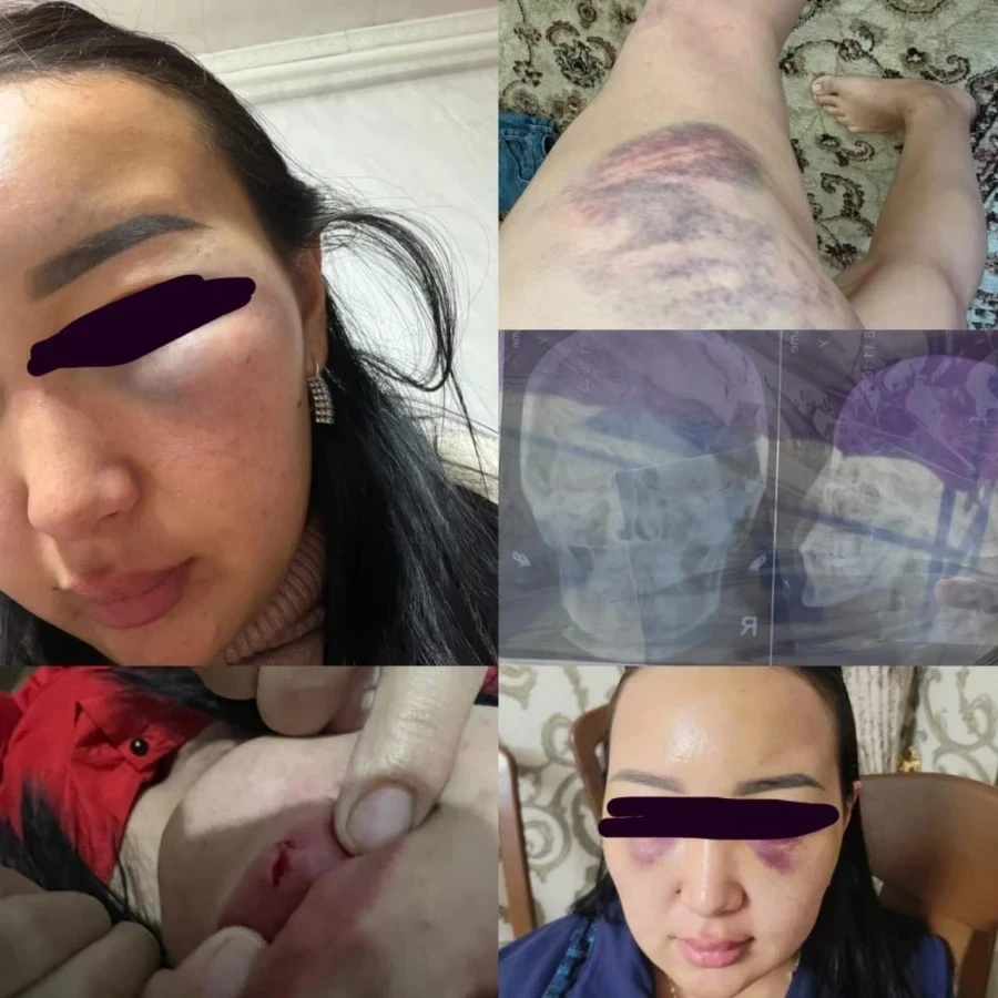 В Кызыл-Кие женщина обвинила экс-супруга — певца — в многолетнем насилии