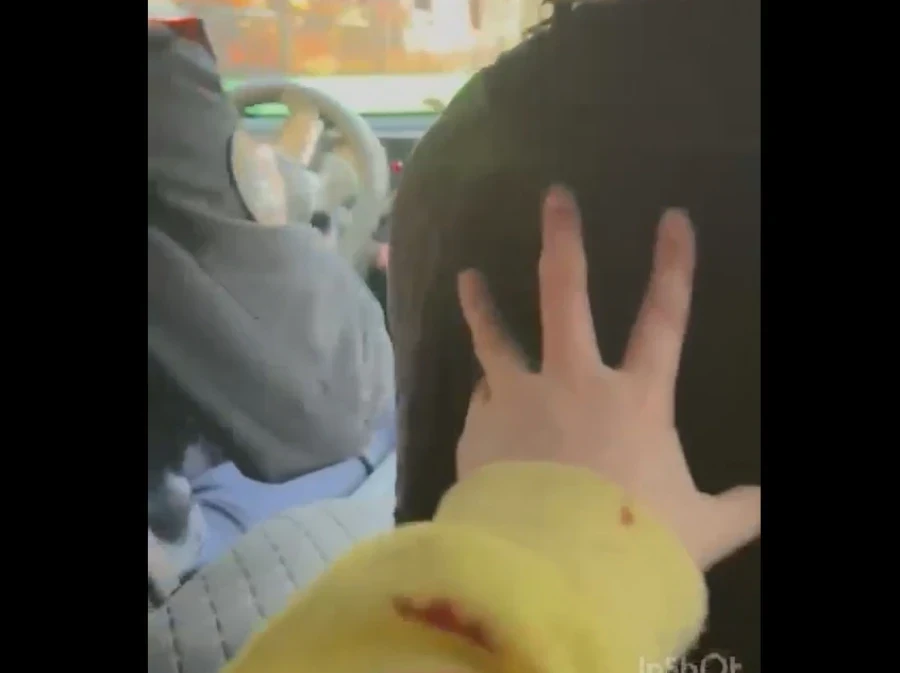 Стая собак покусала 6-летнего ребенка в Бишкеке